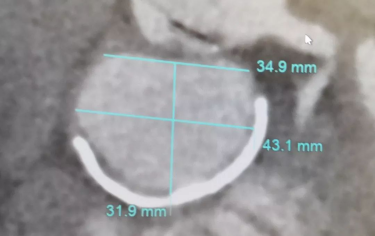 WDCM上传图片 WDCM上传图片